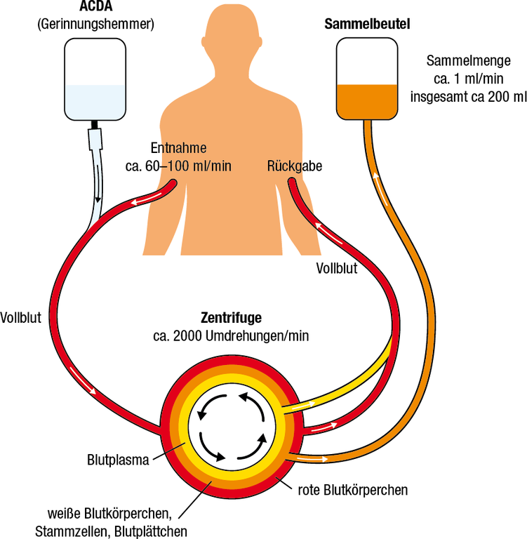 Wer sollte keine Stammzellen spenden?